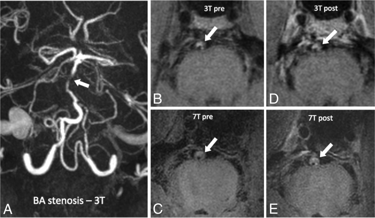 Fig 3.