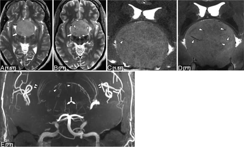 Fig 1.