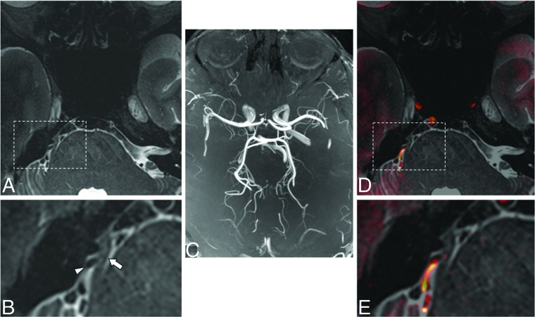 Fig 4.