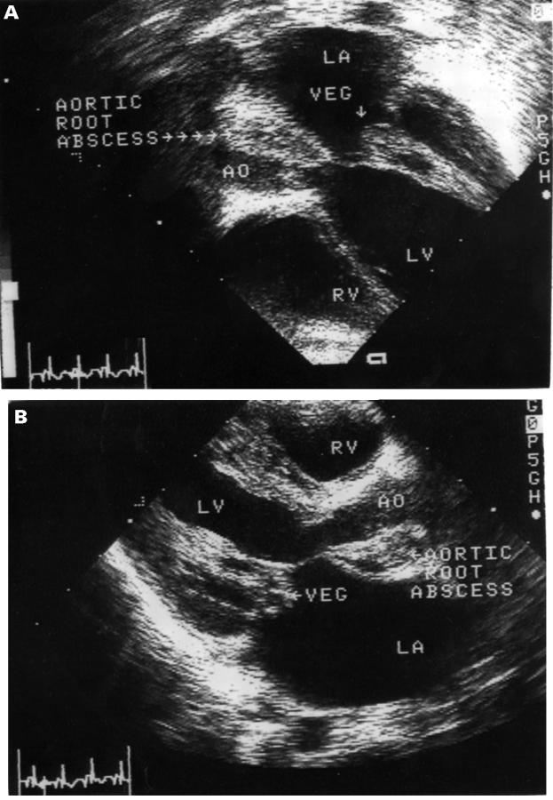 Figure 1  