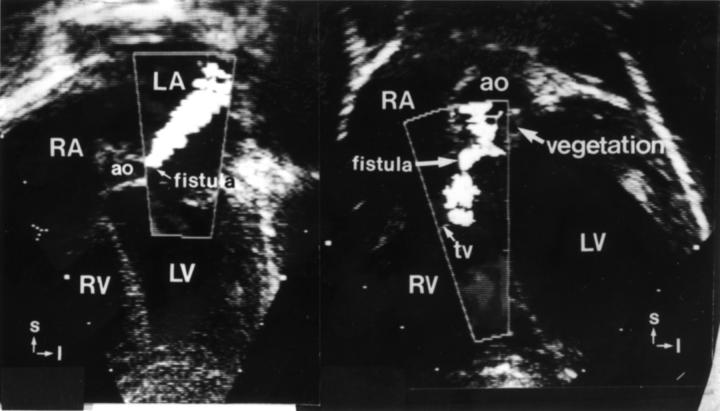 Figure 3  