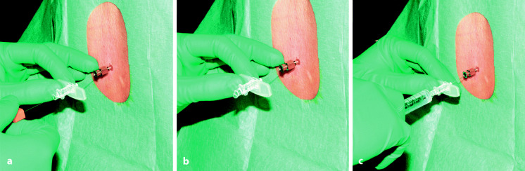 graphic file with name 6376_9_De_13_Fig13_HTML.jpg