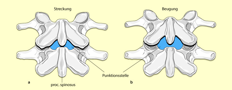 graphic file with name 6376_9_De_13_Fig3_HTML.jpg