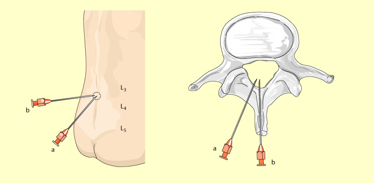 graphic file with name 6376_9_De_13_Fig14_HTML.jpg