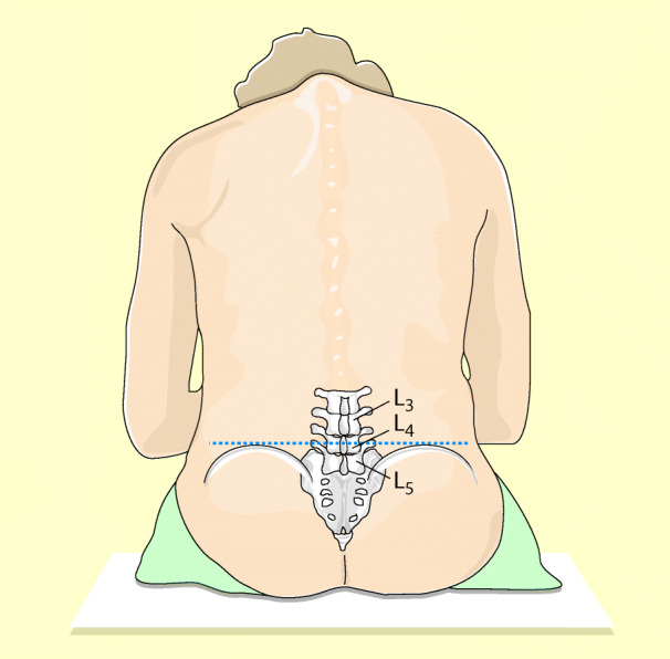 graphic file with name 6376_9_De_13_Fig12_HTML.jpg