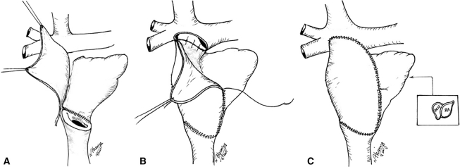 Fig. (10)