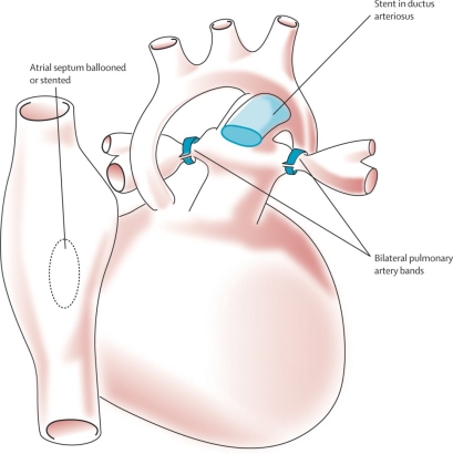 Fig. (12)