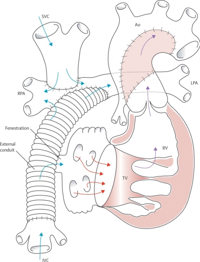 Fig. (11)