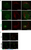 Figure 5—figure supplement 2.