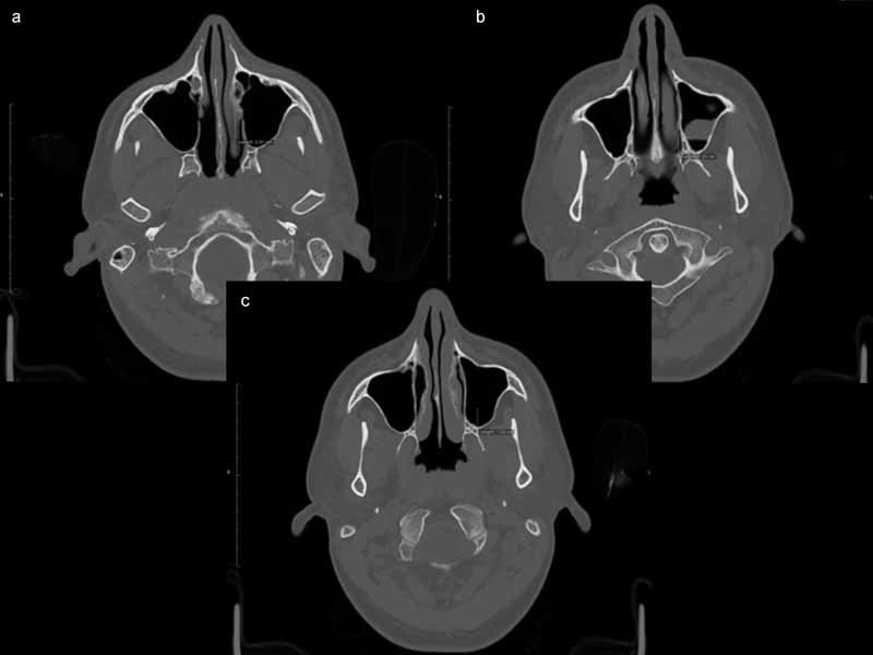 Fig. 5