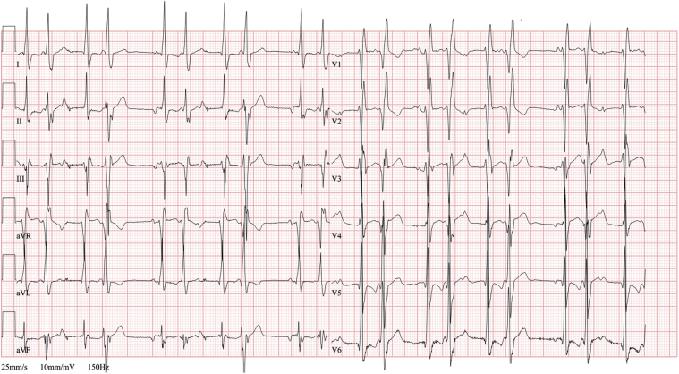 Figure 6