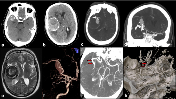 Fig. 8