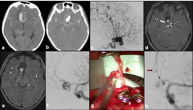 Fig. 9