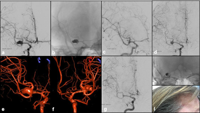 Fig. 10