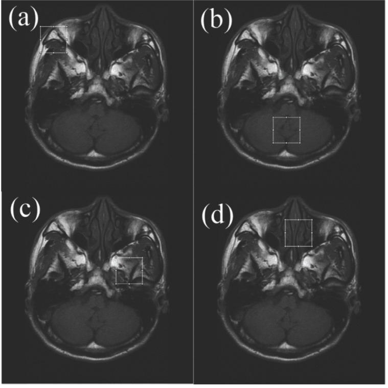 Fig. (5)