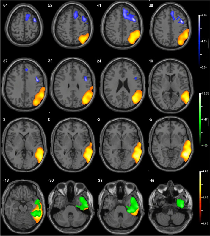 Fig. 3