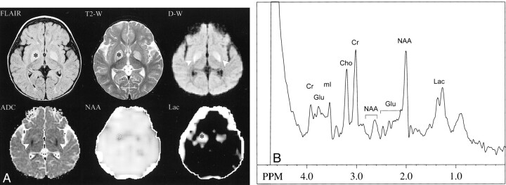 fig 1.