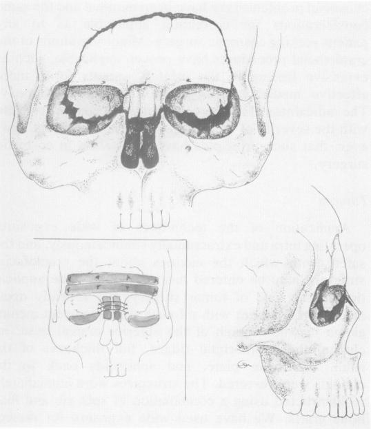 Fig. 1c.