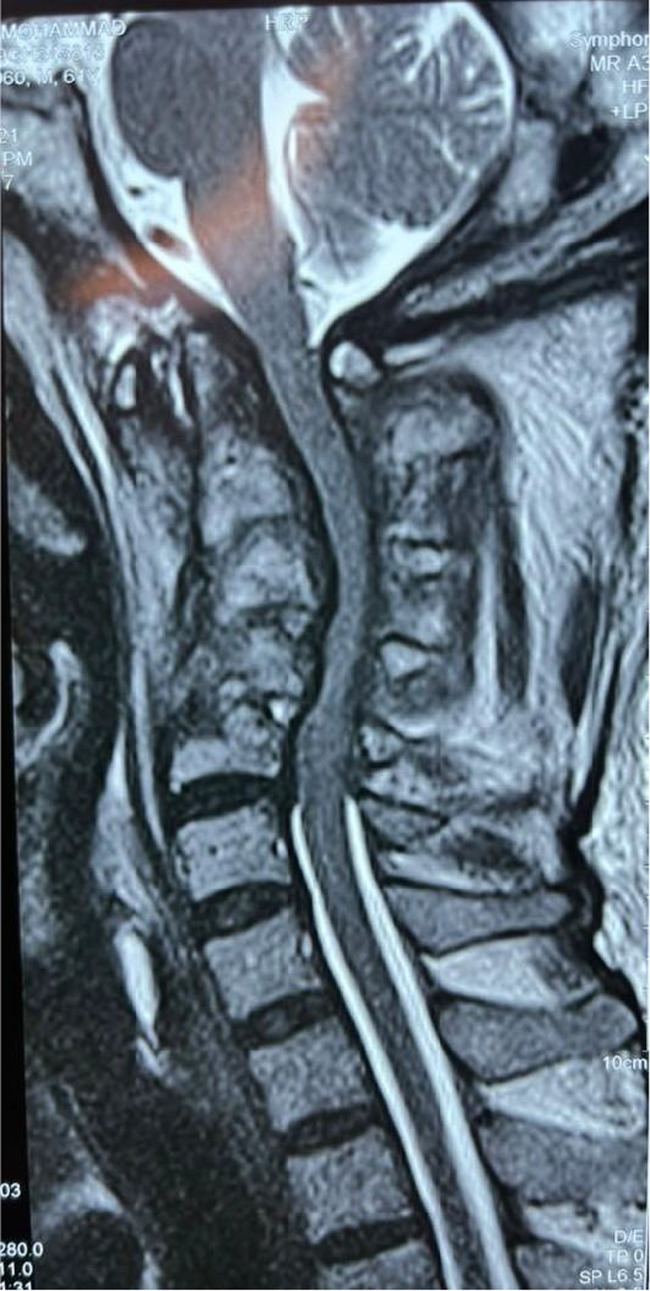 FIGURE 2