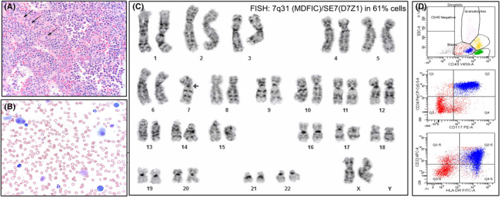 FIGURE 1