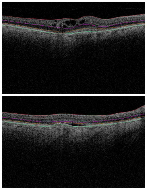 Fig. 4