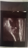Figure 11: