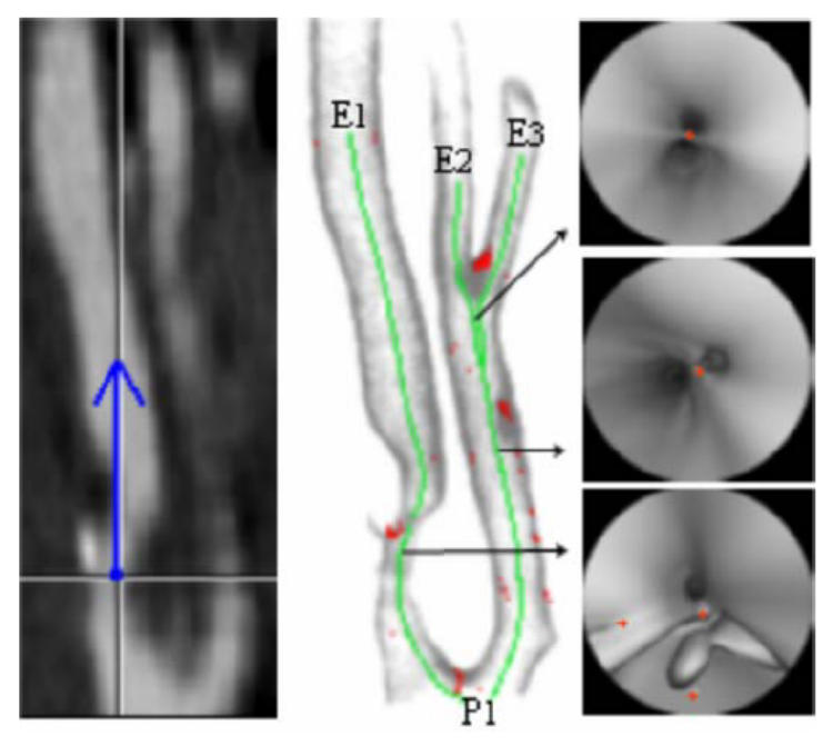 Fig. 9