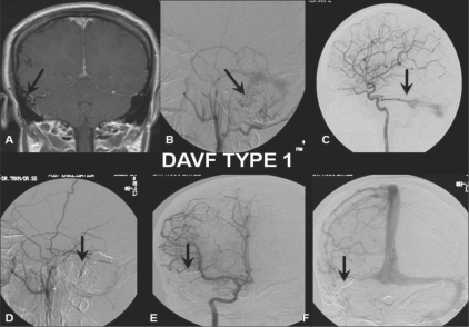 Figure 1: (A-F)