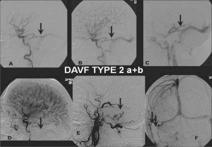 Figure 2: (A-F)