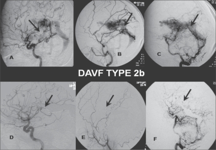 Figure 3: (A-F)