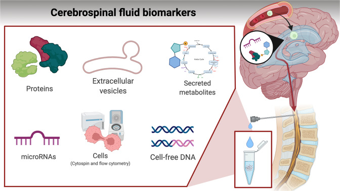 Central nervous system involvement in childhood acute lymphoblastic ...