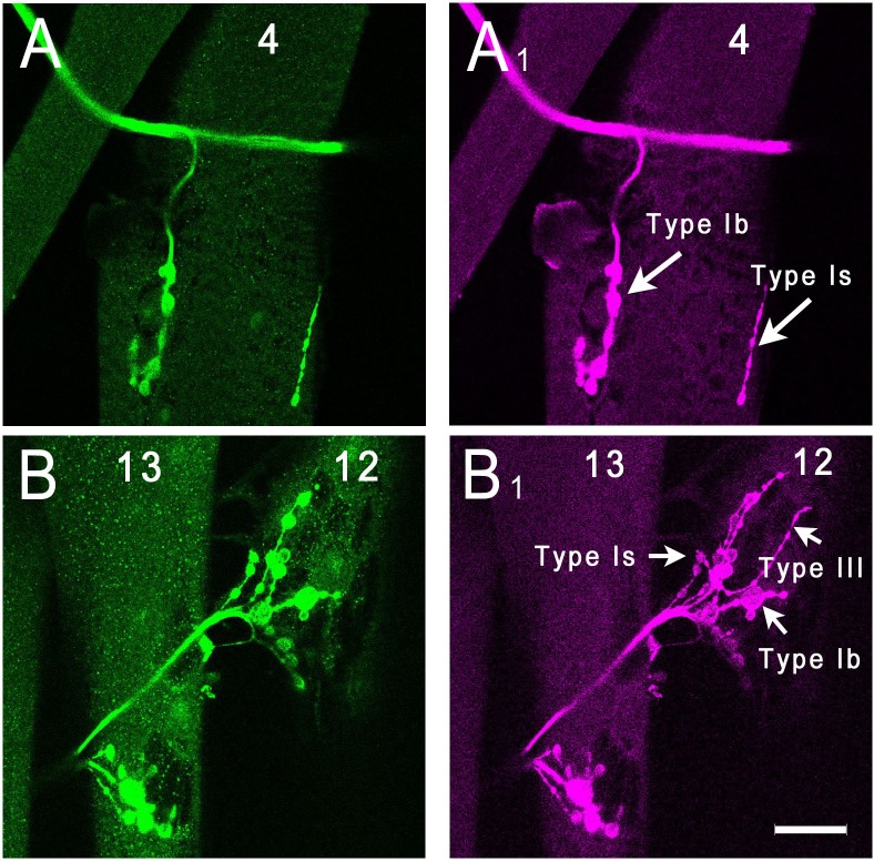 Figure 6—figure supplement 1.