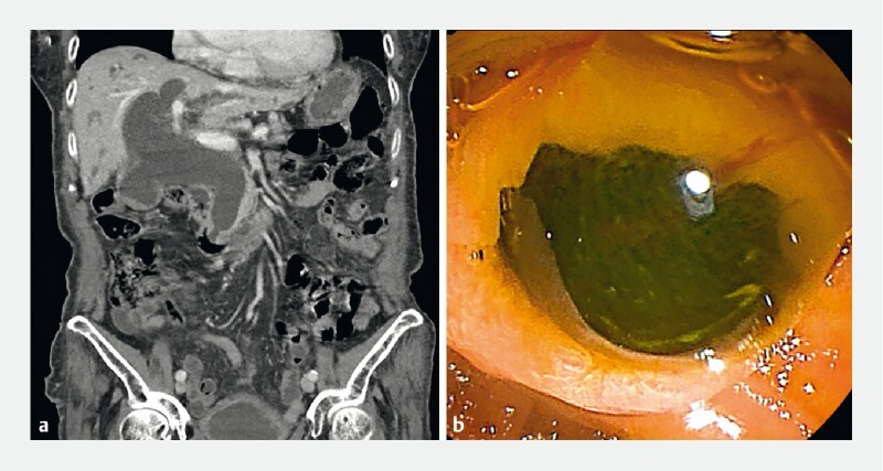 Fig. 1