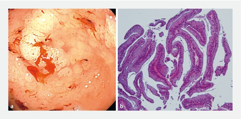 Fig. 2