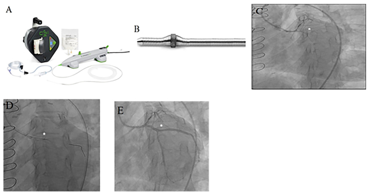 Fig. 5