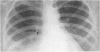 218-2