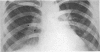 218-2