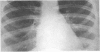 218-2