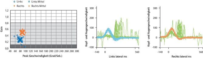 graphic file with name 60_2021_7595_Fig2_HTML.jpg