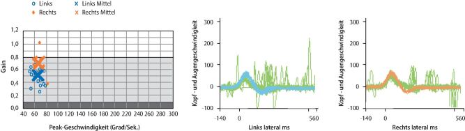 graphic file with name 60_2021_7595_Fig3_HTML.jpg