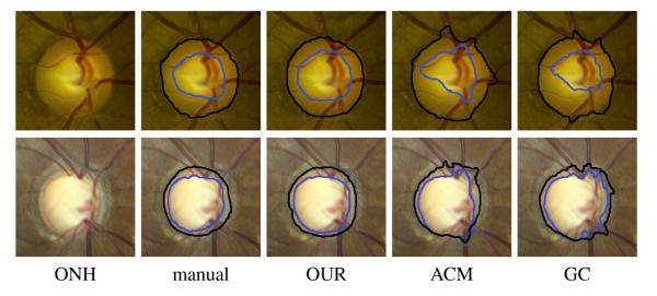 Fig. 2