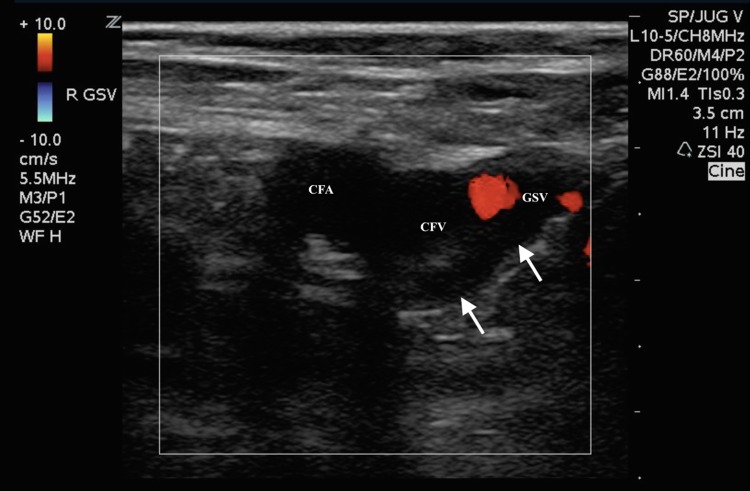 Fig. 3