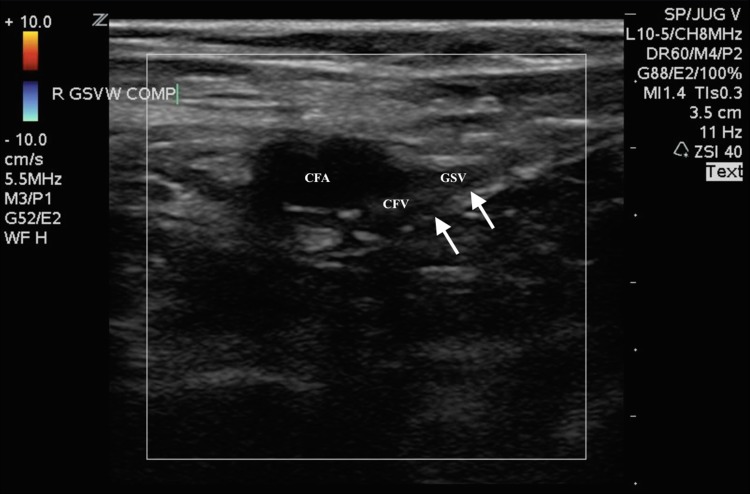 Fig. 4