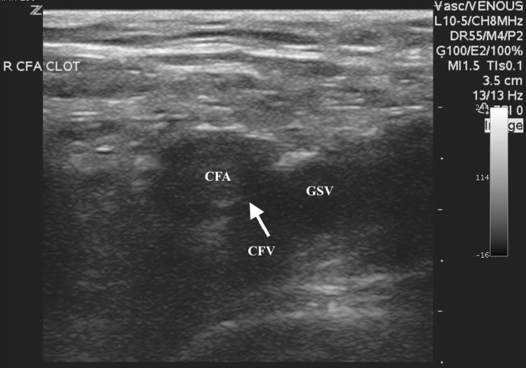 Fig. 1