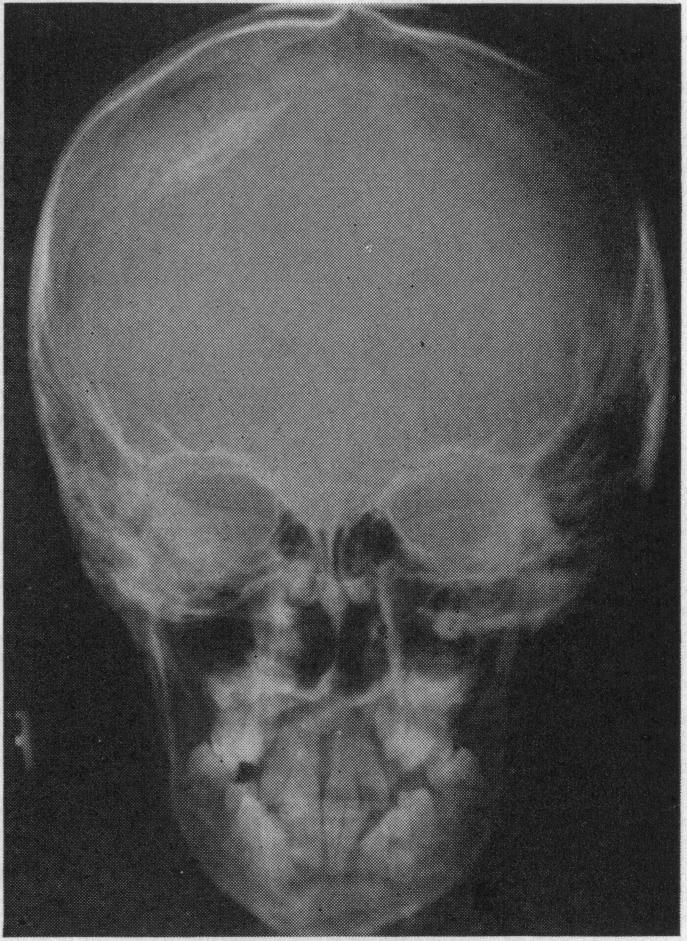 FIG. 21.