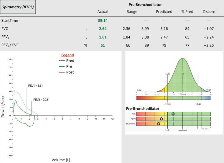 Basic spirometry testing and interpretation for the primary care ...