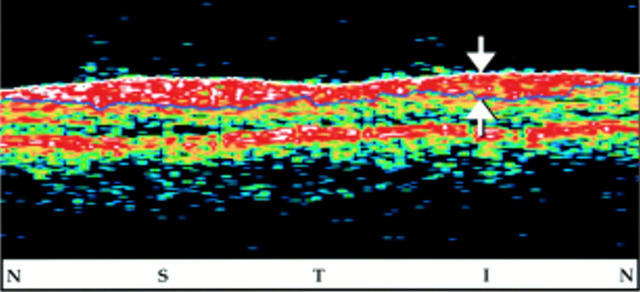 Figure 2  