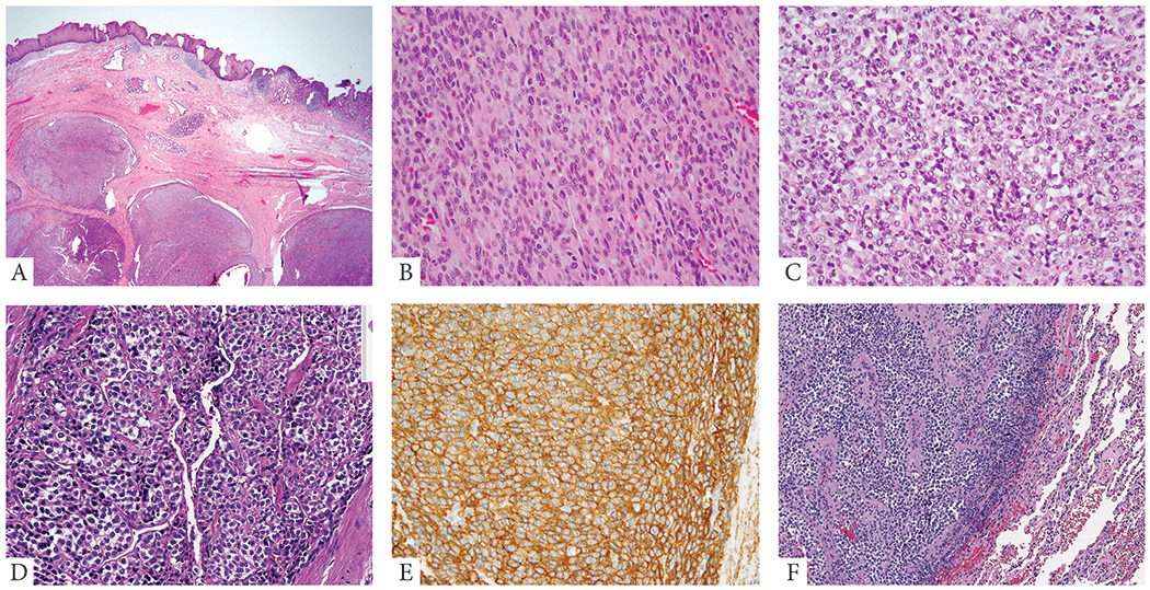 Figure 2: