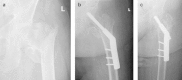 Fig. 4