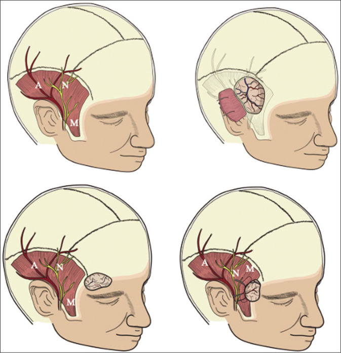 Figure 3: